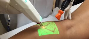 Cirurgiao vascular e angiologista em Sao paulo barueri alphaville