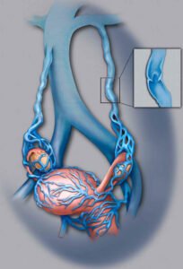 Cirurgiao vascular barueri alphaville sao paulo