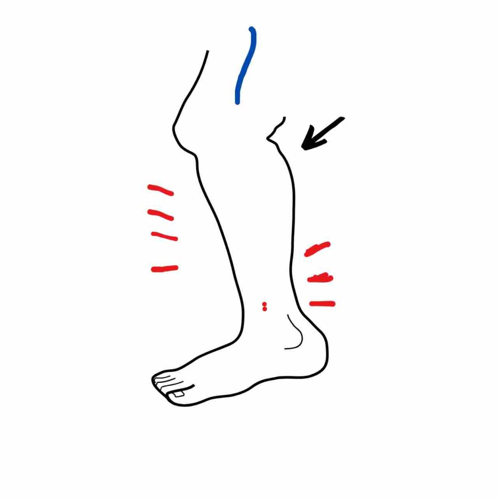 Como Aliviar dor nas pernas